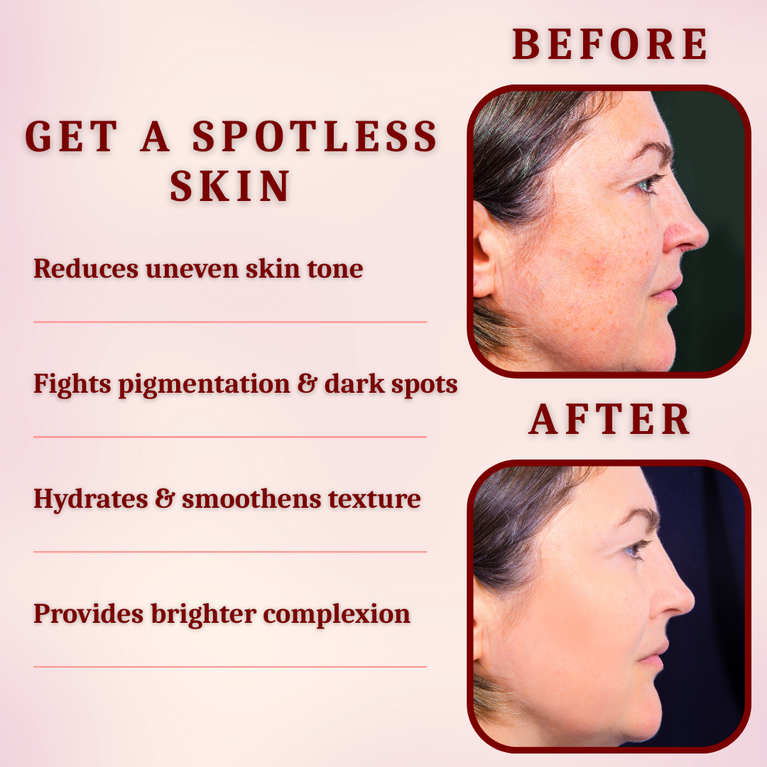 Skin Correcting Serum for Dark Spots Removal & Pigmentation - For Glowing Skin | Vasl (30ml) - Image 5